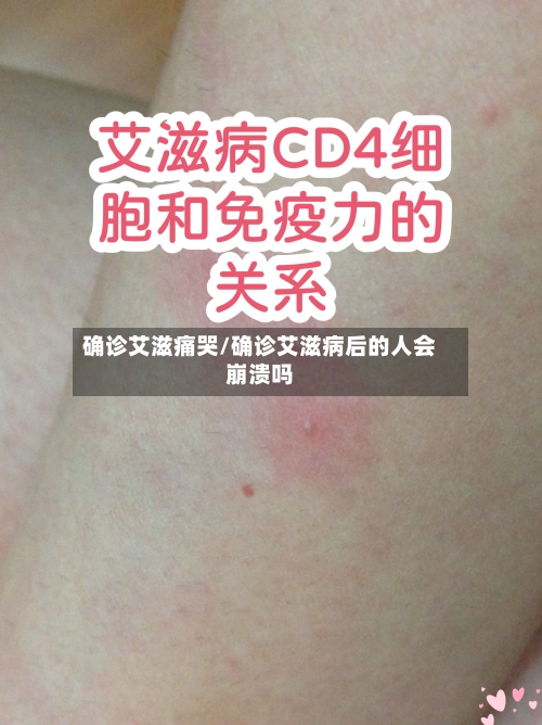 确诊艾滋痛哭/确诊艾滋病后的人会崩溃吗-第2张图片